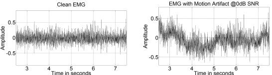 Motion Artifact